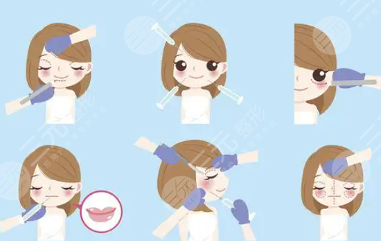 公主玻尿酸價(jià)格