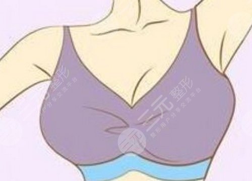 乳房下垂矯正手術(shù)后會(huì)再松弛嗎