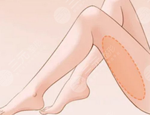 大腿肉注射瘦腿能打嗎