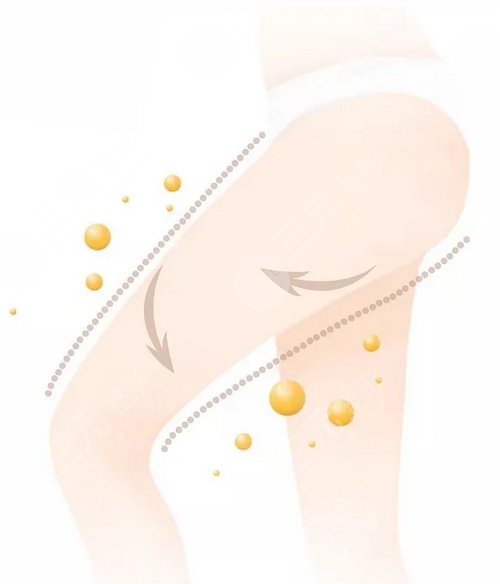 打注射瘦腿多少錢？多少錢一針比較合適？