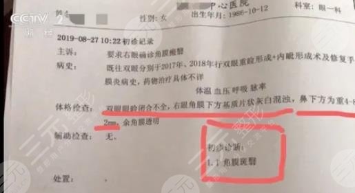 女子整容整出九級(jí)傷殘是真的嗎?