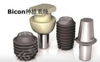 牙齒種植收費(fèi)標(biāo)準(zhǔn)是啥?