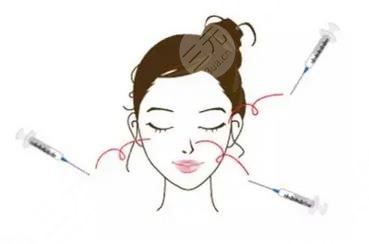 玻尿酸果圖