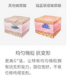 玻尿酸功
