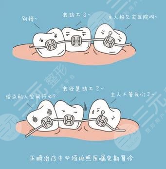 牙齒矯正過程