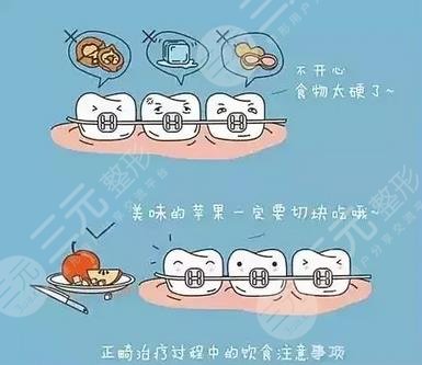 牙齒矯正飲食注意事項(xiàng)