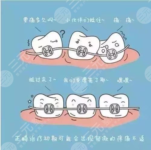 牙齒矯正的危害和后遺癥有什么?