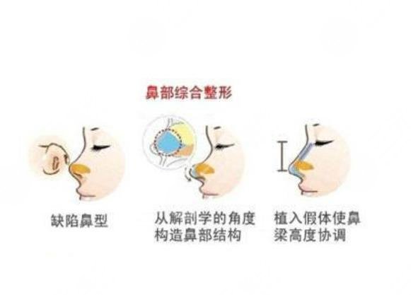 鼻子有點(diǎn)歪怎么辦?可以調(diào)整嗎?