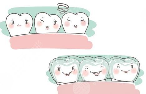 隱形牙套