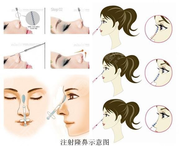 術(shù)后七天