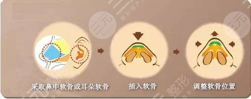 術(shù)后三天
