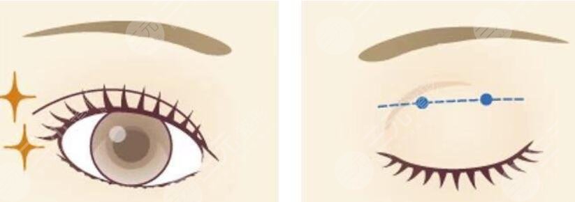 張冰潔主攻整形項目