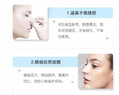膨體品牌排行榜|國(guó)產(chǎn)膨體哪些品牌好?