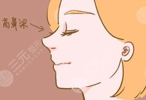 肋骨隆鼻可以維持一輩子嗎