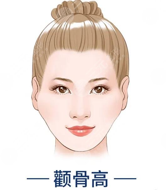 磨顴骨前后對(duì)比圖驚掉網(wǎng)友下巴！術(shù)后告別兇巴巴的氣場(chǎng)，秒變甜美萌妹~