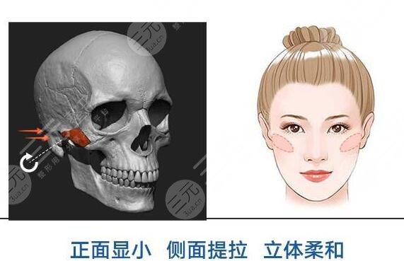 磨顴骨的注意事項(xiàng)