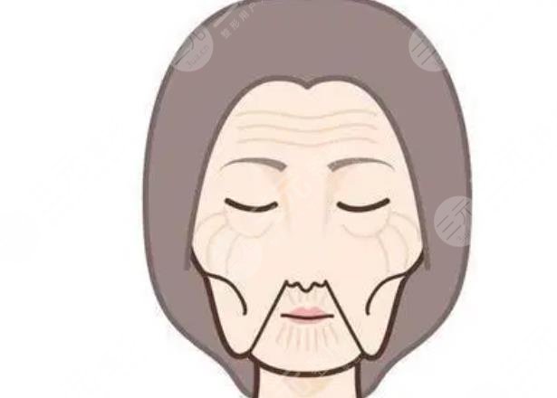 面部松軟下垂