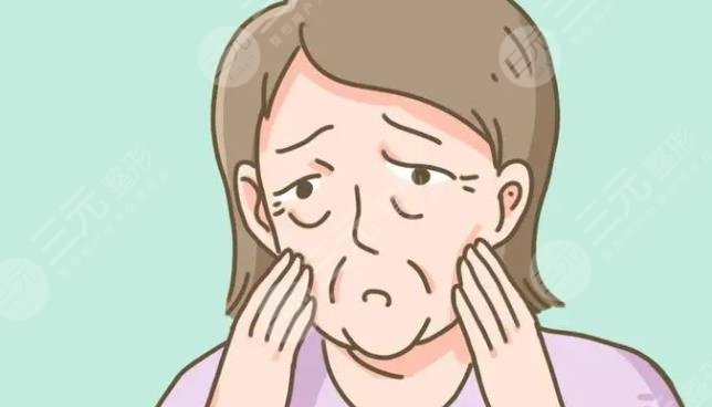 面部松軟下垂