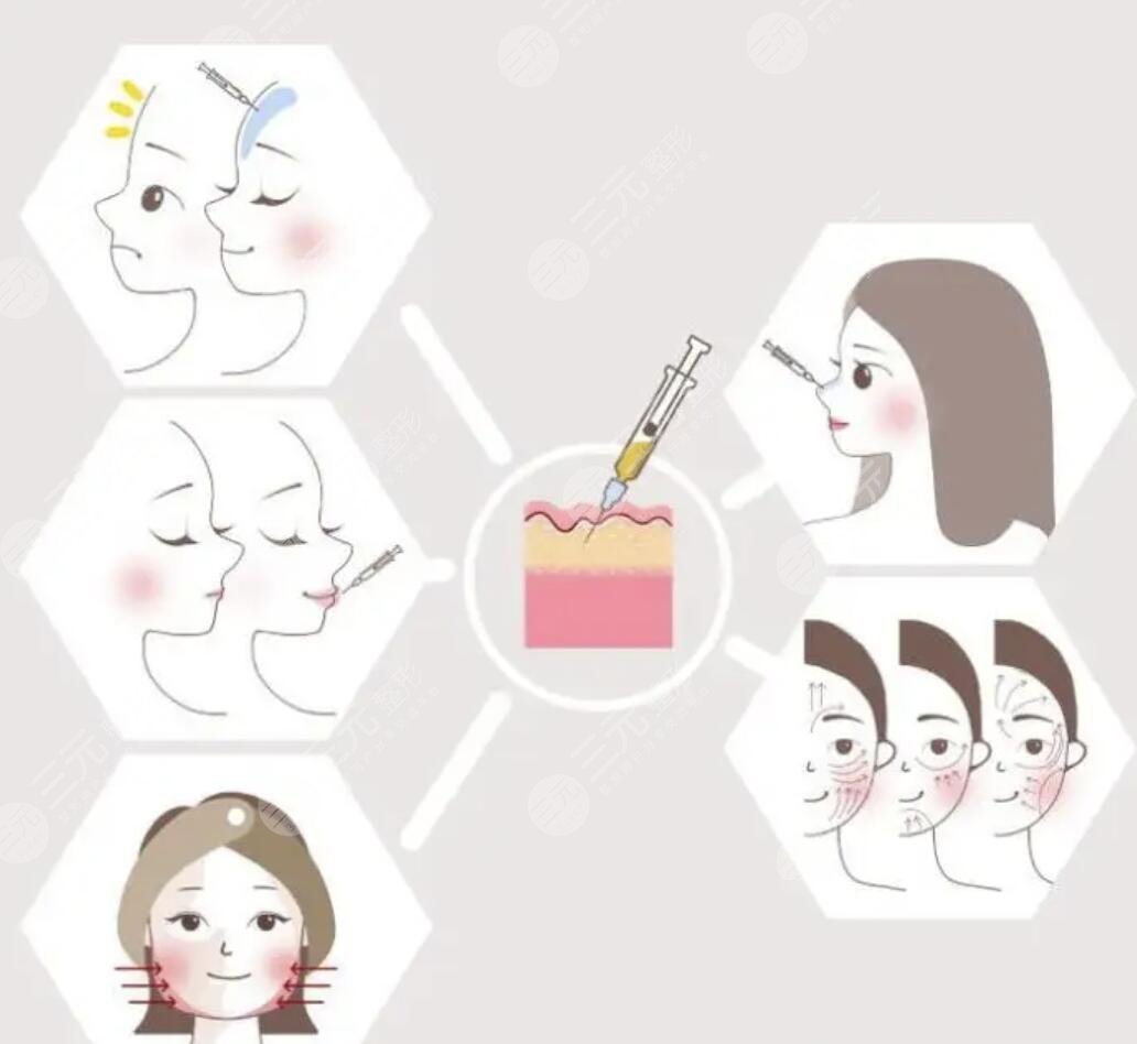 *玻尿酸注射后如何養(yǎng)護皮膚果維持時間長？