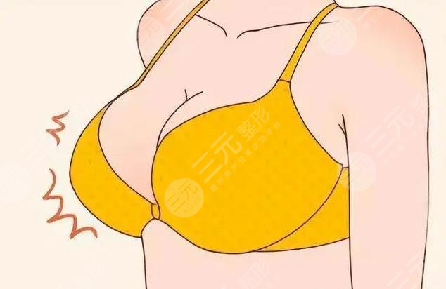 乳房縮小棒棒糖手術法怎么樣