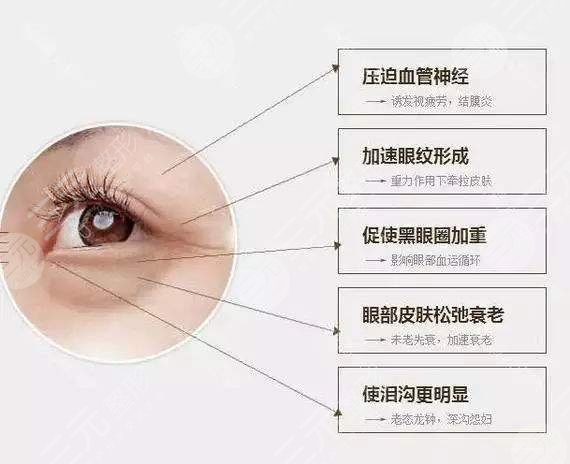 眼袋怎么消除？激光、吸脂、切除3個簡單的方法盤點(diǎn)！趕緊get起來~