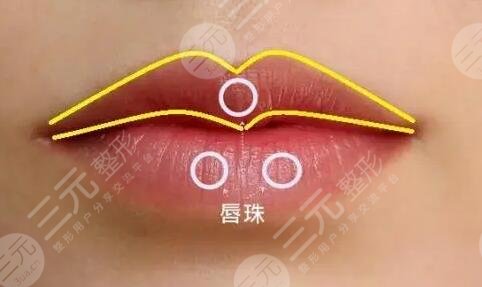 m唇