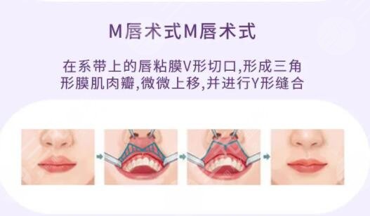 m唇