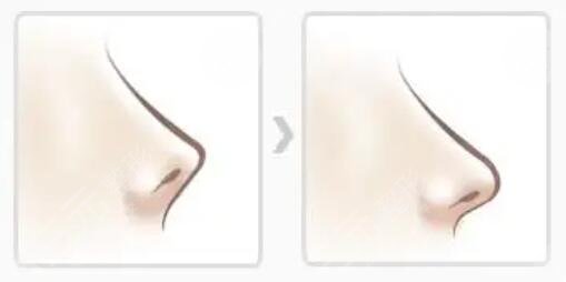 杜**醫(yī)生坐診醫(yī)院擅長項目科普