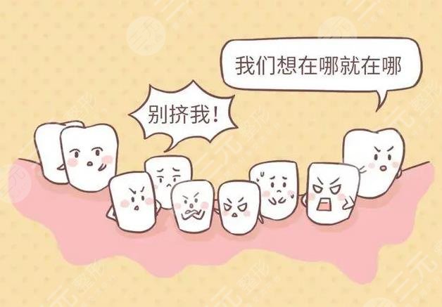 番禺中心醫(yī)院口腔科畸形矯正案例分享