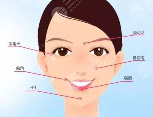 玻尿酸填充法令紋多少錢