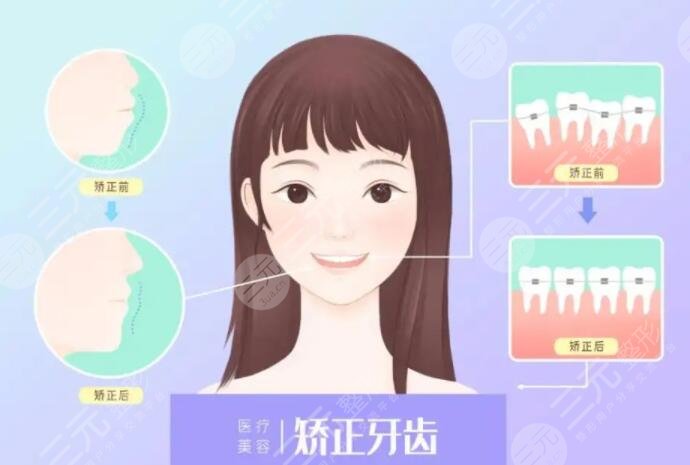 牙齒矯正年齡限制在多少歲？幾歲是正畸的黃金年齡？來(lái)看看你處在哪個(gè)年齡段！