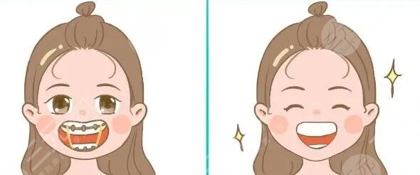 牙齒矯正年齡限制在多少歲？