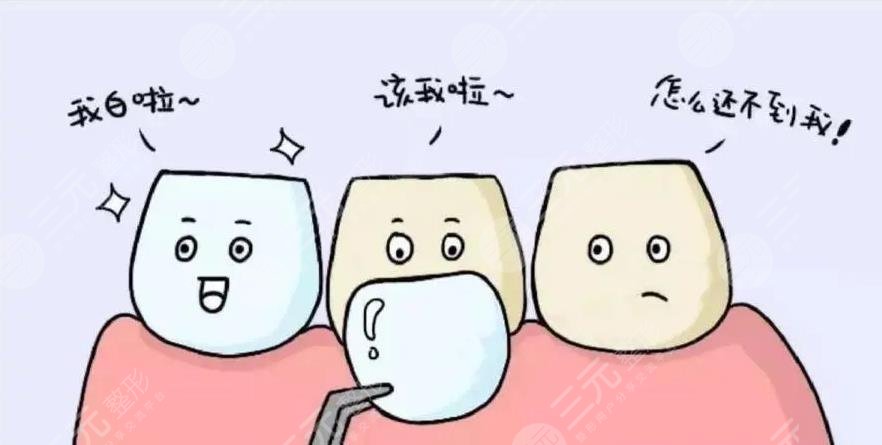 牙科科普項(xiàng)目介紹