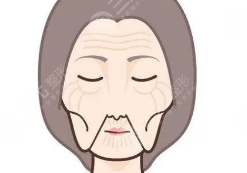 去法令紋的小竅門