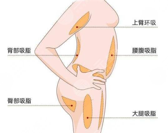光纖溶脂瘦大腿術(shù)后注意事項