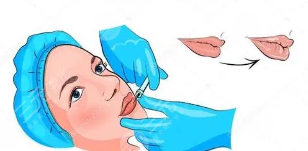 豐唇