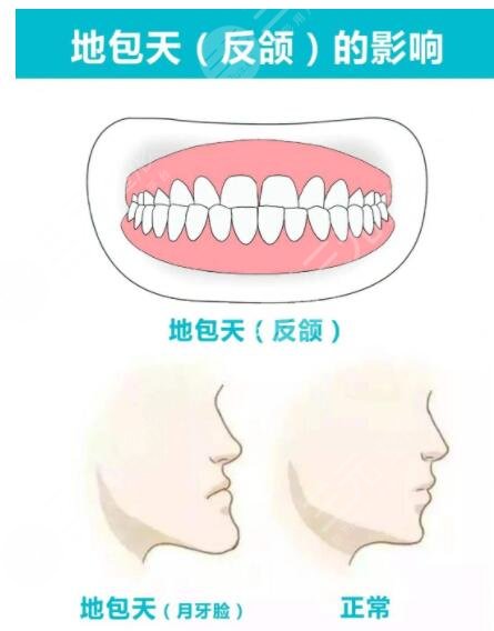 北京八大處正頜項(xiàng)目科普