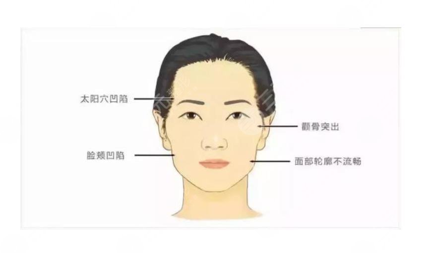 心形臉