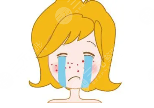 e光祛痘多少錢一次？