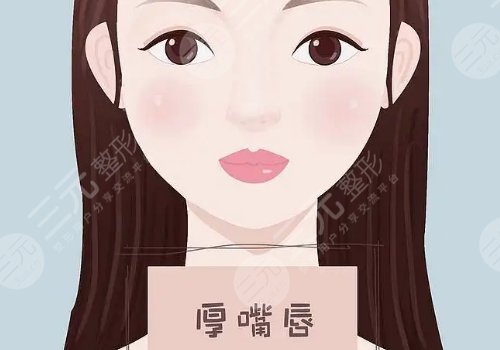 厚唇變薄手術(shù)多少錢？