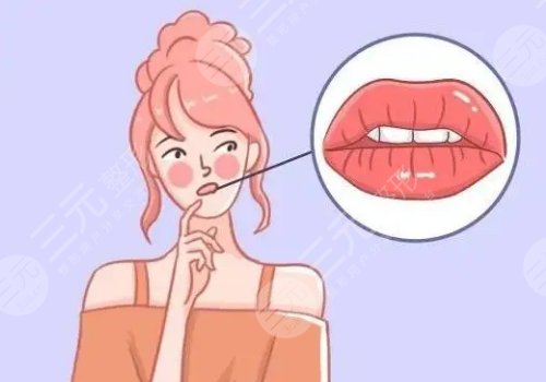 厚唇變薄手術(shù)多少錢？