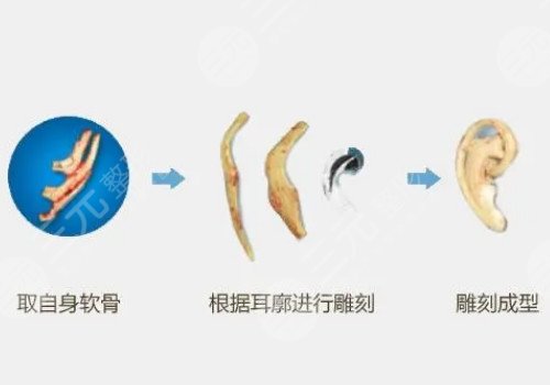 郭樹忠醫(yī)生擅長項目介紹