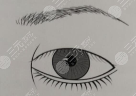 開眼角