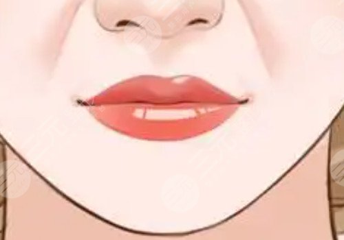 厚嘴唇怎么變??？