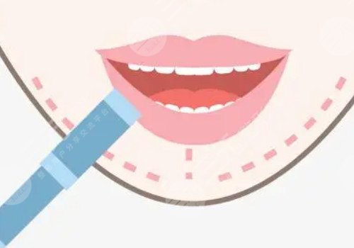 厚嘴唇怎么變??？