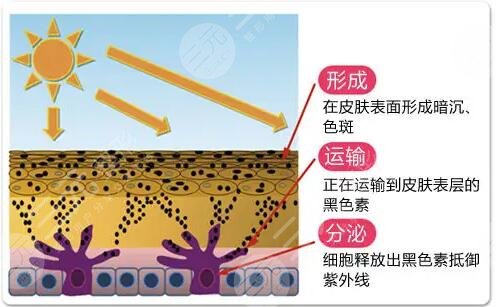 激光美白的價格是多少?