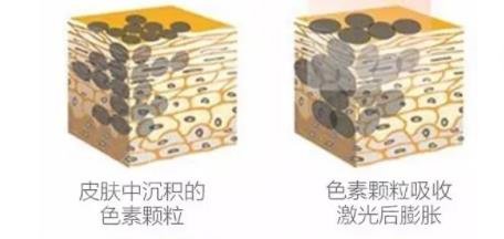 洗眉