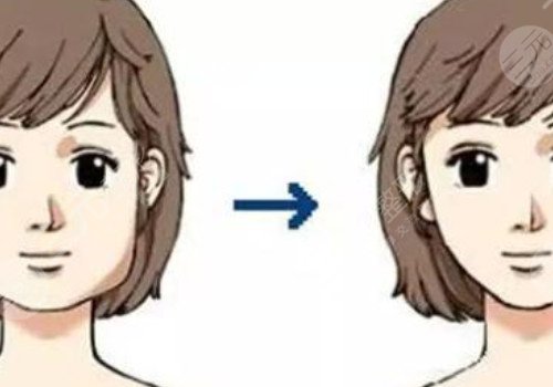 咬肌發(fā)達(dá)怎么瘦下來?