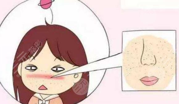 毛孔縮小