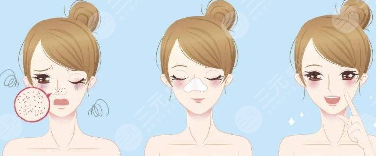 毛孔縮小
